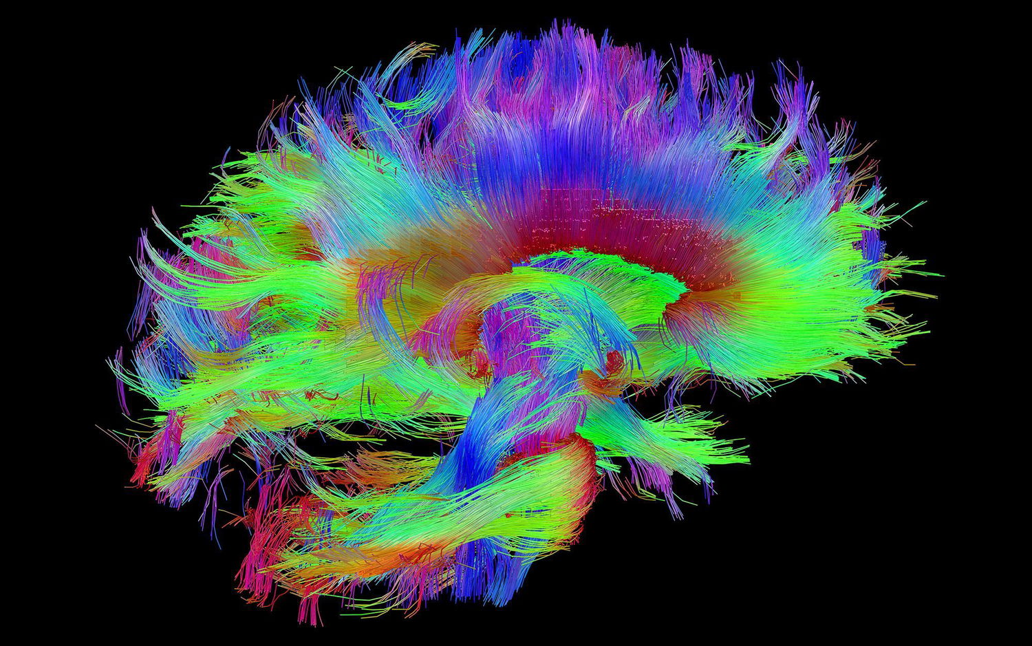 Mapping the brain's connective structure could unlock immortality | Aeon Essays